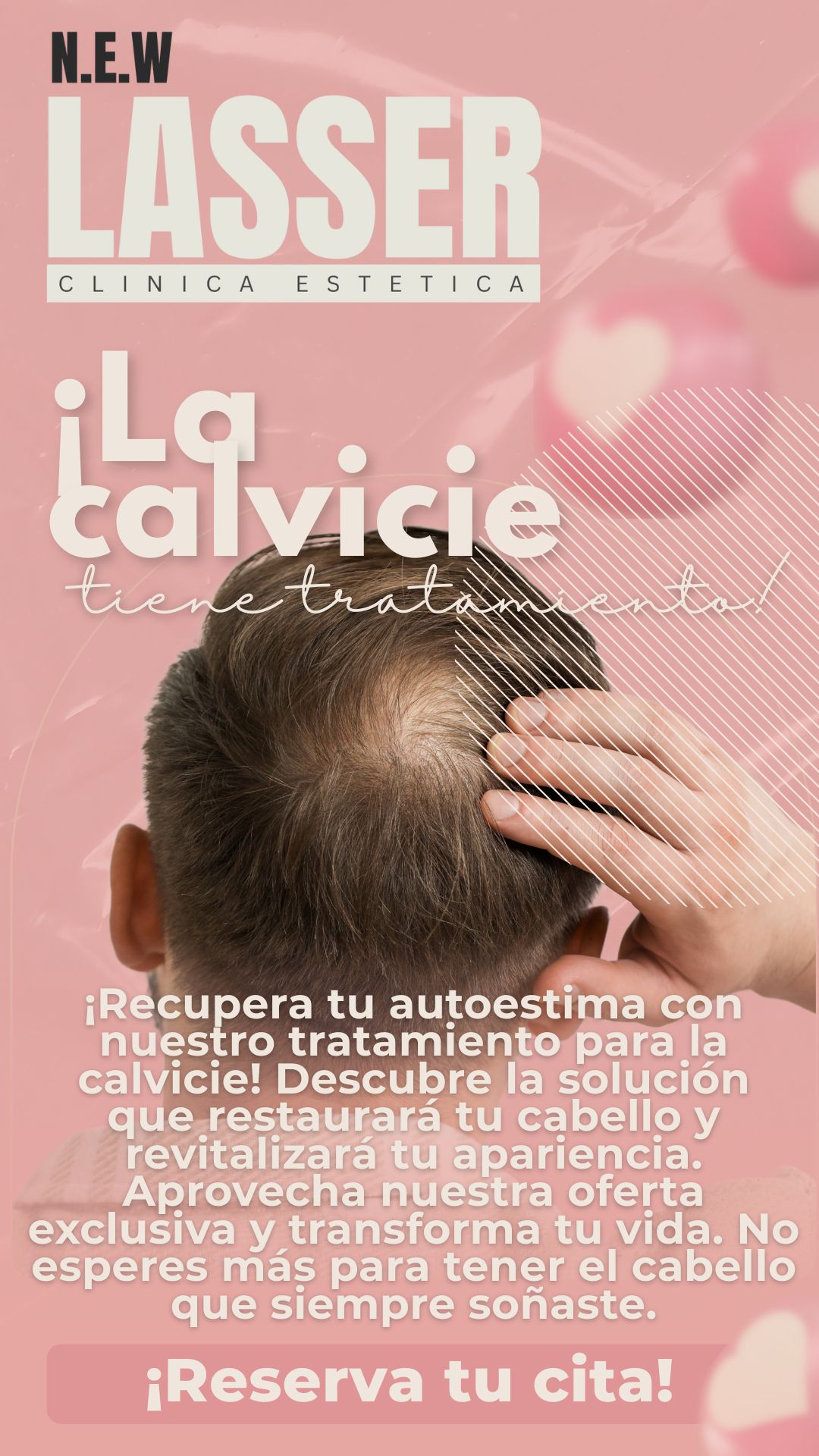Tratamiento para Calvicie